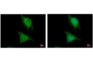 ICC/IF Image Laforin antibody [C2C3], C-term detects EPM2A protein at cytoplasm by immunofluorescent analysis. (EPM2A 抗体  (C-Term))