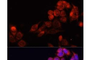 Immunofluorescence analysis of HeLa cells using SLC16A4 Polyclonal Antibody at dilution of 1:100. (SLC16A4 抗体)