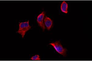 ABIN6257661 and ABIN6274208 staining Hela by IF/ICC.