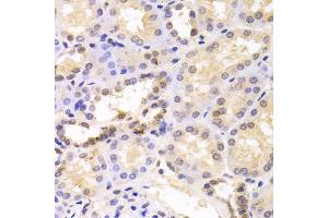 Immunohistochemistry of paraffin-embedded human kidney using PSMC6 antibody (ABIN5973113) at dilution of 1/100 (40x lens). (PSMC6 抗体)