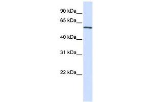 ALAS2 antibody used at 1 ug/ml to detect target protein. (ALAS2 抗体  (C-Term))