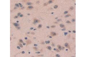 IHC-P analysis of Mouse Tissue, with DAB staining. (DKK4 抗体  (AA 37-141))