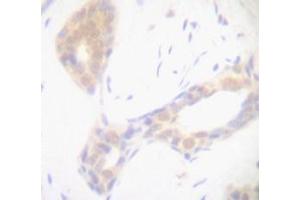 Image no. 1 for anti-Tumor Necrosis Factor alpha (TNF alpha) antibody (ABIN465674) (TNF alpha 抗体)
