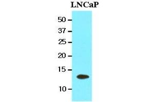 Cell lysates of LnitrocelluloseaP(20 ug) were resolved by SDS-PAGE, transferred to nitrocellulose membrane and probed with anti-human TBCA (1:1000). (TBCA 抗体  (AA 1-108))