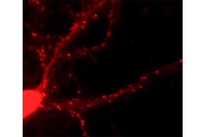 Immunofluorescence labeling of a hippocampus neuron (dilution 1 : 500). (SH3G2 抗体  (AA 256-276))