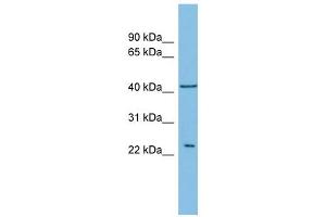 RALB antibody used at 1 ug/ml to detect target protein. (RALB 抗体)