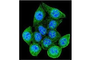 Confocal immunofluorescent analysis of RAD9A Antibody  with 293 cell followed by Alexa Fluor 488-conjugated Goat anti-Rabbit lgG (green). (RAD9A 抗体)