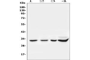 Western blot analysis of SDCBP using anti-SDCBP antibody (ABIN6719608).