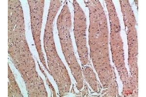 Immunohistochemical analysis of paraffin-embedded Human-colon, antibody was diluted at 1:100 (PIK3R2 抗体  (AA 1-60))