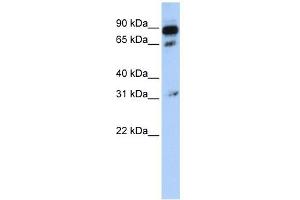 ABCD4 antibody used at 1 ug/ml to detect target protein.