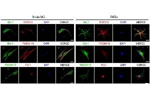 Immunocytochemical staining of IBA-1, P2RY12, TMEM119, and PU.