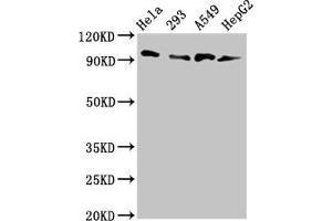 Western Blot Positive WB detected in: Hela whole cell lysate, 293 whole cell lysate, A549 whole cell lysate, HepG2 whole cell lysate All lanes: MACC1 antibody at 3 μg/mL Secondary Goat polyclonal to rabbit IgG at 1/50000 dilution Predicted band size: 97 kDa Observed band size: 97 kDa (MACC1 抗体  (AA 371-514))