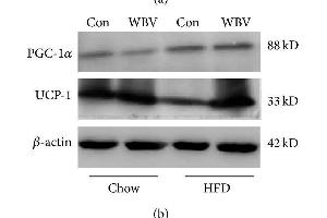Protein expression of UCP1 and PGC-1α in WAT. (UCP1 抗体  (AA 101-200))