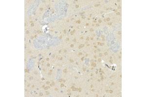 Immunohistochemistry of paraffin-embedded rat brain using CNTN4 Rabbit mAb (ABIN7266495) at dilution of 1:100 (40x lens).
