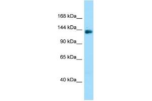 WB Suggested Anti-PPP1R9A Antibody Titration: 1. (PPP1R9A 抗体  (C-Term))