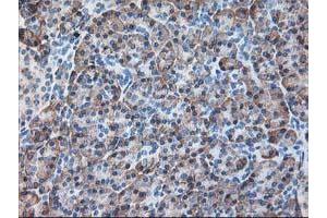 Image no. 3 for anti-Ribophorin 1 (RPN1) antibody (ABIN1500748) (RPN1 抗体)