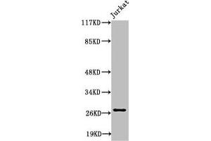 Western Blot analysis of Jurkat cells using Cleaved-Tumstatin (P1426) Polyclonal Antibody (COL4a3 抗体  (Cleaved-Pro1426))