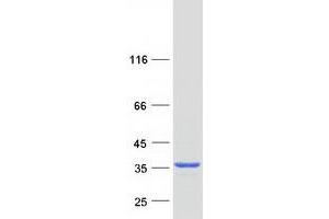 Validation with Western Blot (RLBP1 Protein (Myc-DYKDDDDK Tag))