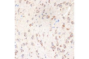 Immunohistochemistry of paraffin-embedded mouse brain using CYPOR Rabbit mAb (ABIN7269151) at dilution of 1:100 (40x lens). (POR 抗体)