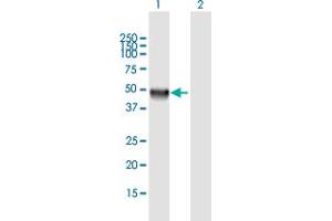 Western Blot analysis of CLN5 expression in transfected 293T cell line by CLN5 MaxPab polyclonal antibody. (CLN5 抗体  (AA 1-407))