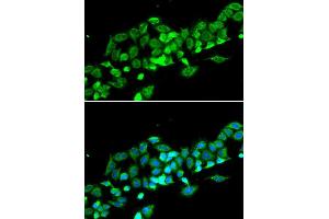 Immunofluorescence analysis of MCF-7 cell using RASSF1 antibody. (RASSF1 抗体  (AA 101-340))
