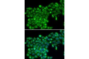 Immunofluorescence analysis of MCF7 cell using TNFSF13 antibody. (TNFSF13 抗体  (AA 105-247))