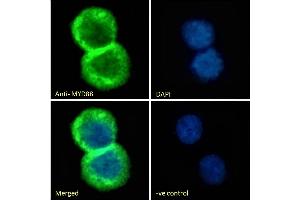 (ABIN185362) Immunofluorescence analysis of paraformaldehyde fixed Jurkat cells, permeabilized with 0. (MYD88 抗体  (Internal Region))