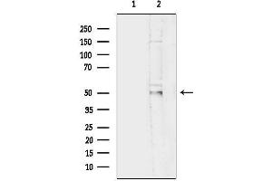 anti-Fukutin Related Protein (FKRP) (N-Term) antibody