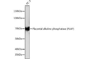 Western blot analysis of extracts of PC-3 cells, using Placental alkaline phosphatase (PLAP) Rabbit mAb (ABIN1682693, ABIN7101664, ABIN7101665 and ABIN7101666) at 1:1000 dilution. (PLAP 抗体)