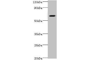 Western blot All lanes: SHC4 antibody at 6 μg/mL + Jurkat whole cell lysate Secondary Goat polyclonal to rabbit IgG at 1/10000 dilution Predicted band size: 69, 43 kDa Observed band size: 69 kDa (SHC4 抗体  (AA 1-185))