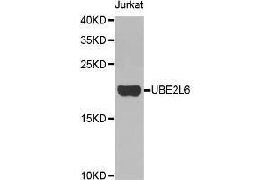 Western blot analysis of extracts of Jurkat cell line, using UBE2L6 antibody. (UBE2L6 抗体)