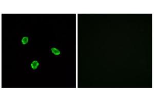 Immunofluorescence analysis of A549 cells, using SSTR1 antibody. (SSTR1 抗体  (N-Term))