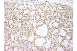 Immunohistochemistry (IHC) image for anti-Tumor Protein P73 (TP73) (AA 1-62) antibody (ABIN7448710)