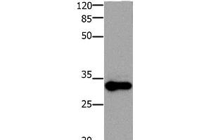 Western Blot analysis of Mouse testis tissue using ADO Polyclonal Antibody at dilution of 1:1200 (ADO 抗体)