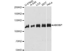 Western blot analysis of extracts of various cell lines, using ABI3BP antibody. (ABI3BP 抗体)