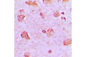 Immunohistochemical analysis of NDUFA4 staining in human brain formalin fixed paraffin embedded tissue section. (NDUFA4 抗体  (C-Term))