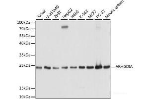 Western blot analysis of extracts of various cell lines using ARHGDIA Polyclonal Antibody at dilution of 1:1000. (ARHGDIA 抗体)