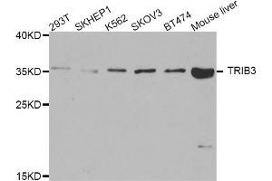 Western blot analysis of extracts of various cell lines, using TRIB3 antibody. (TRIB3 抗体)