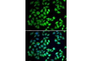 Immunofluorescence analysis of A549 cell using WDR77 antibody. (WDR77 抗体)
