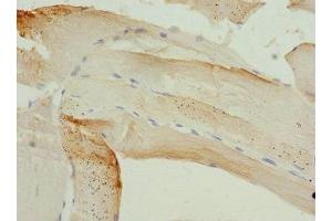 Immunohistochemistry of paraffin-embedded human skeletal muscle tissue using ABIN7163187 at dilution of 1:100 (PIP5K1B 抗体  (AA 190-470))