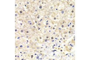 Immunohistochemistry of paraffin-embedded human liver injury using FKBP4 Antibody.