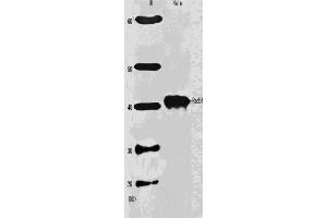 Western Blotting (WB) image for anti-DNA Repair Protein Homolog 1 (RAD51) antibody (ABIN2452093) (RAD51 抗体)