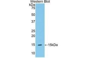 Detection of Recombinant C1INH, Mouse using Polyclonal Antibody to Complement 1 Inhibitor (C1INH)