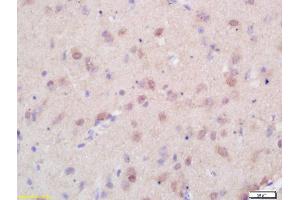 Formalin-fixed and paraffin embedded rat brain labeled with Rabbit Anti Menin/Men1 Polyclonal Antibody, Unconjugated (ABIN676343) at 1:200 followed by conjugation to the secondary antibody and DAB staining (Menin 抗体  (AA 501-615))