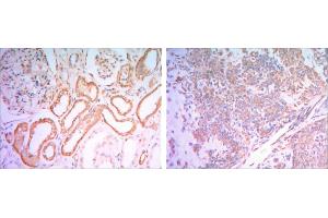 Immunohistochemical analysis of paraffin-embedded human salivary gland tissues (left) and kidney tissues (right) using HK1 antibody with DAB staining. (Hexokinase 1 抗体)