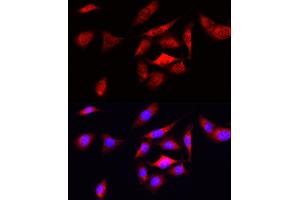 Immunofluorescence analysis of U2OS cells using ODC1 Rabbit pAb (ABIN3015743, ABIN3015744, ABIN3015745 and ABIN6219097) at dilution of 1:50 (40x lens). (ODC1 抗体  (AA 1-280))