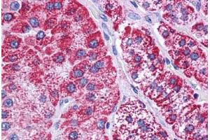 Immunohistochemistry (Formalin-fixed Paraffin-embedded Sections) (IHC (fp)) image for anti-Hydroxyacyl-CoA Dehydrogenase/3-Ketoacyl-CoA Thiolase/enoyl-CoA Hydratase (Trifunctional Protein), beta Subunit (HADHB) (AA 351-400) antibody (ABIN604755)