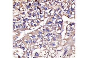 IHC analysis of IFIT5 using anti-IFIT5 antibody (ABIN7600752). (IFIT5 抗体  (AA 23-439))