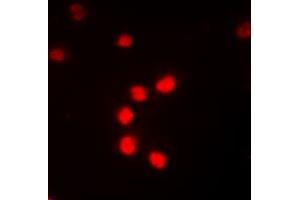 Immunofluorescent analysis of NF-kappaB p65 (pT435) staining in K562 cells. (NF-kB p65 抗体  (C-Term, pSer435))