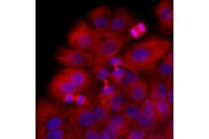 Immunofluorescence (IF) image for anti-Tubulin, beta 2B (TUBB2B) antibody (ABIN567629) (TUBB2B 抗体)